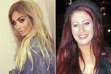 chloe ferry before surgery|chloe ferry then and now.